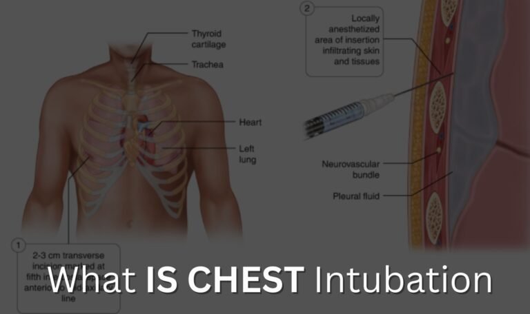 What is Chest Intubation